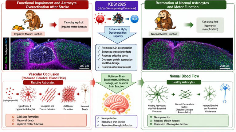 Experimental drug may restore movement after stroke