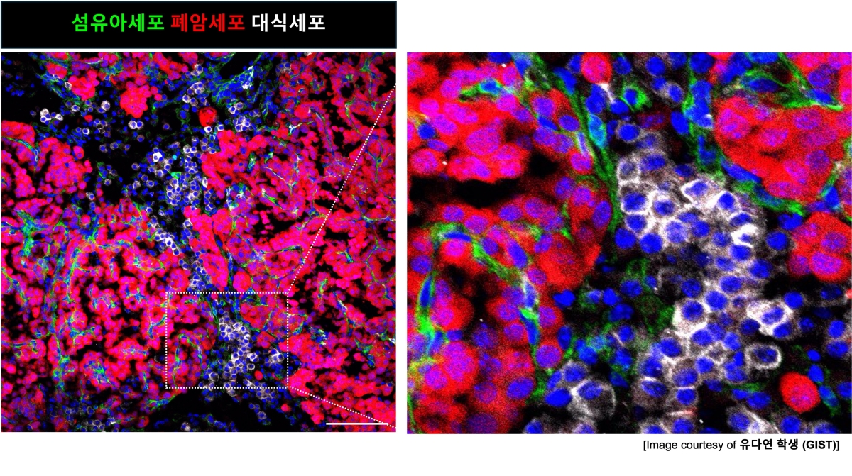 암 발생 전부터 몸은 암세포 성장 최적 환경으로 변한다