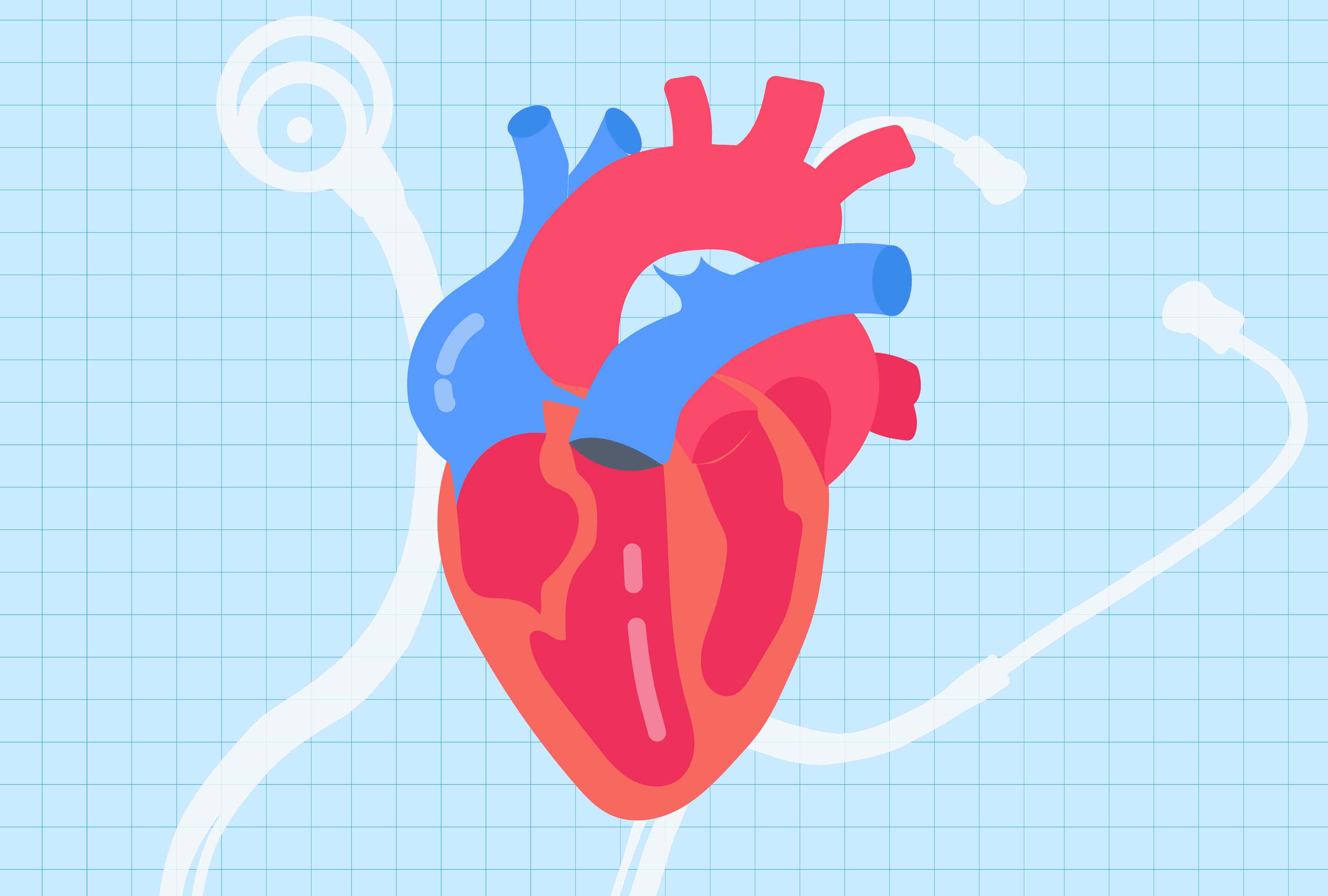 5 heart-health myths dietitians want you to stop believing