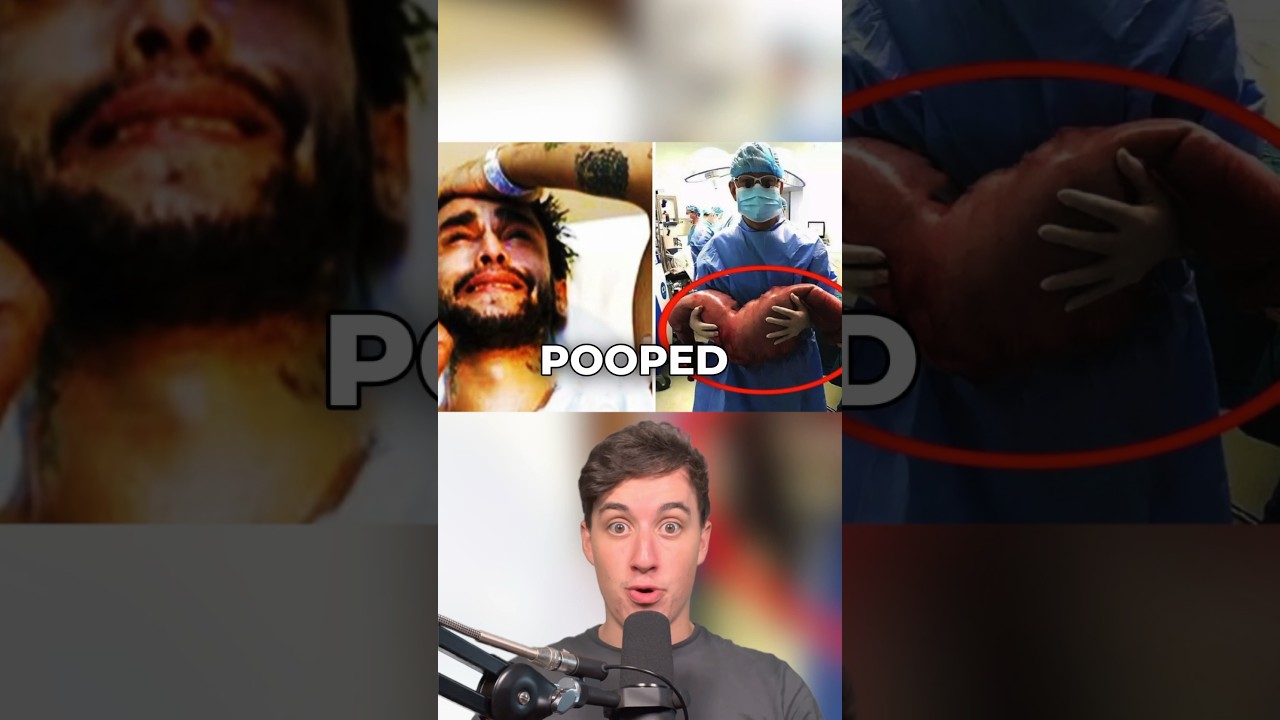 Man reportedly survives 22 years without bowel movement