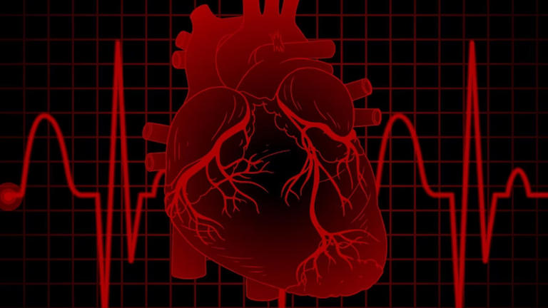 How does a heart attack happen? A step-by-step breakdown, causes, risk ...