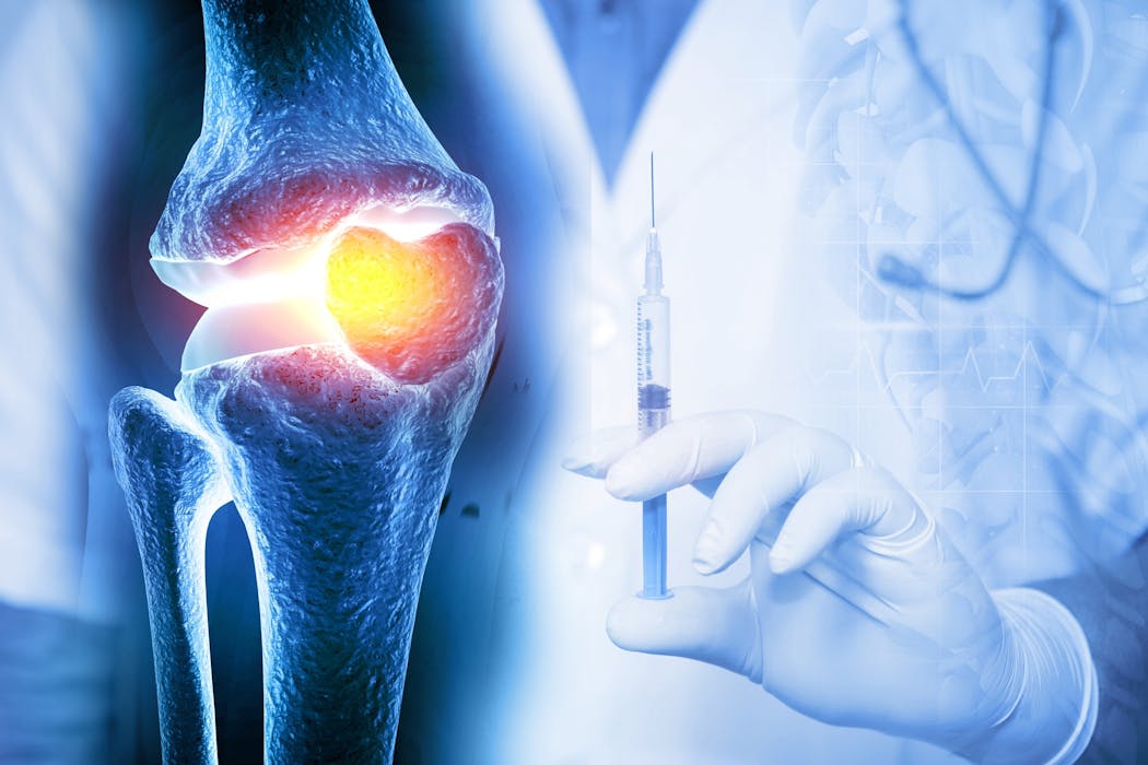 Steroid injections for joint pain: everything you need to know about ...