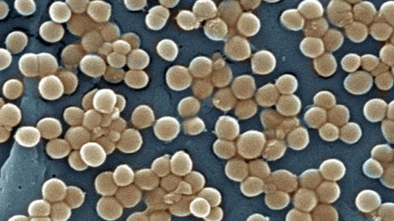 A resistência aos antibióticos das bactérias isoladas nas cavernas ajuda os pesquisadores a encontrar novas substâncias para uso farmacêutico