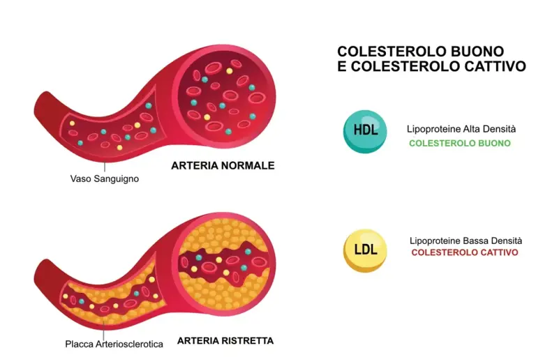 Colesterolo HDL e LDL: differenze spiegate semplice