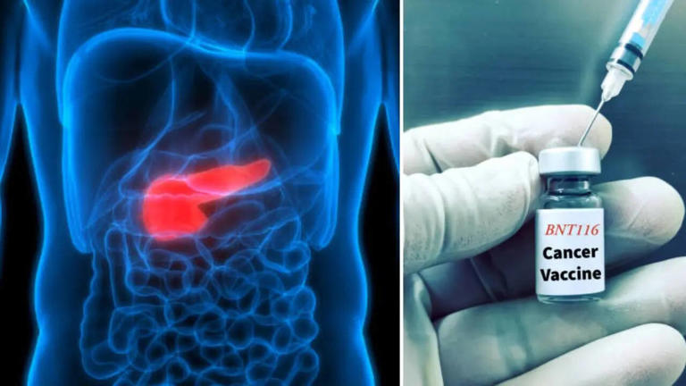 Pancreatic cancer breakthrough: Personalised vaccine shows 6-year ...