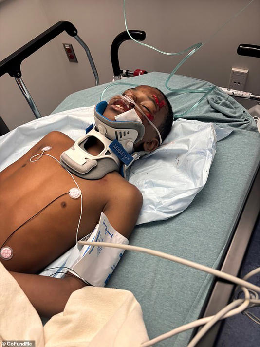 Jahari spent five days in the hospital after being knocked unconscious, suffering brain trauma, a spinal injury and a pierced hole in his cheek