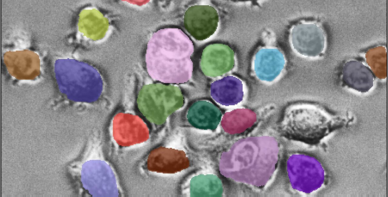 AI algorithm identifies cells across diverse biological images, cutting ...