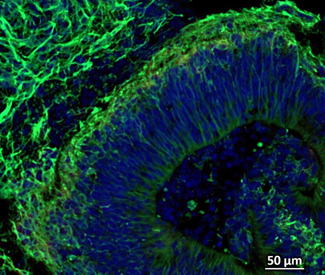 Mini brain-like structures grown in lab may help scientists treat ...