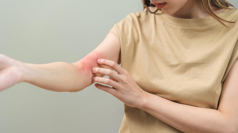 Home remedies for itching: ये 6 उपाय दूर करेंगे शरीर में होने वाली खुजली!