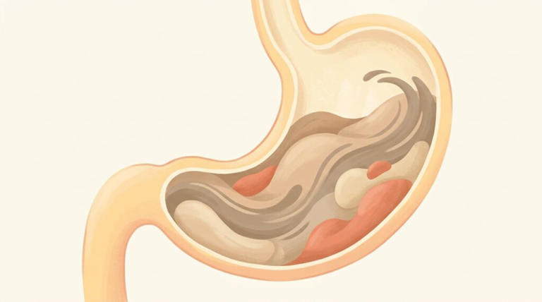 Café em jejum pode irritar o estômago e aumentar o refluxo.