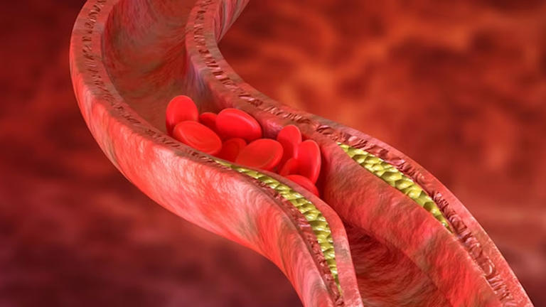 What High Blood Pressure Really Does to Your Body?