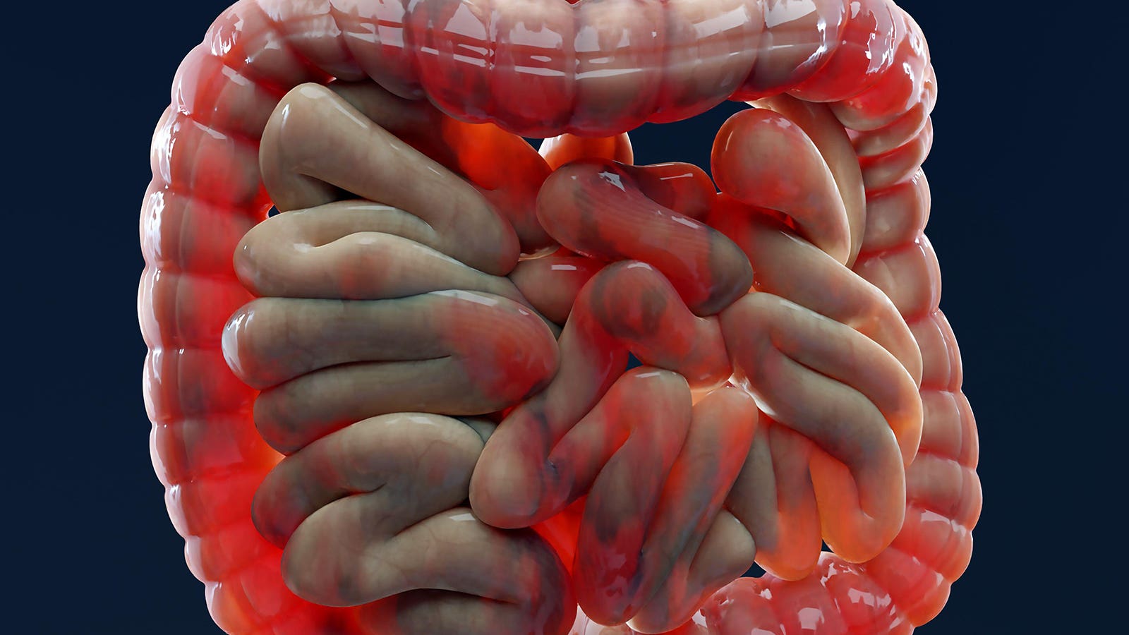 Are NSAIDs genuinely too dangerous in inflammatory bowel disease?