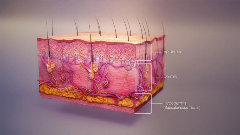 Study finds injured skin cells rapidly ramp up protein-making hubs
