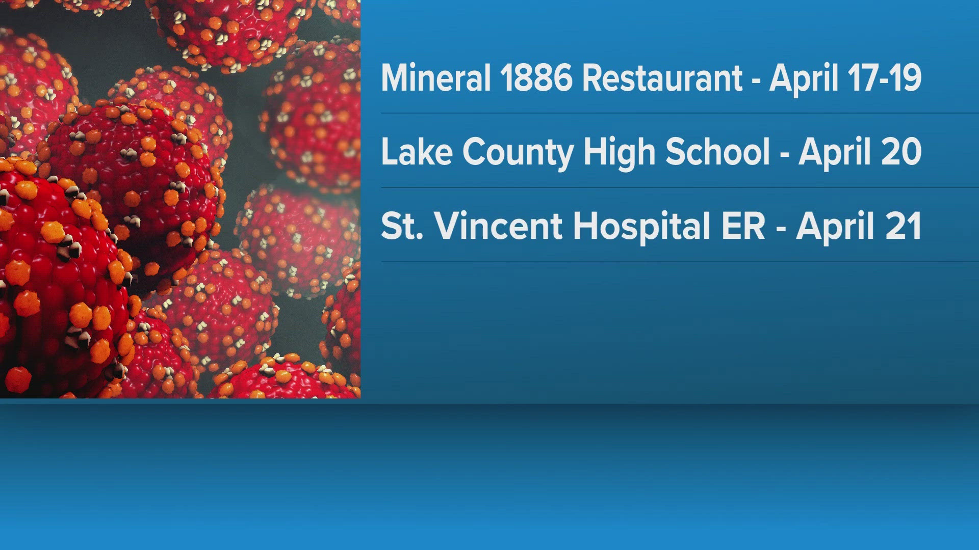 Health officials warn of possible measles exposure in Lake County