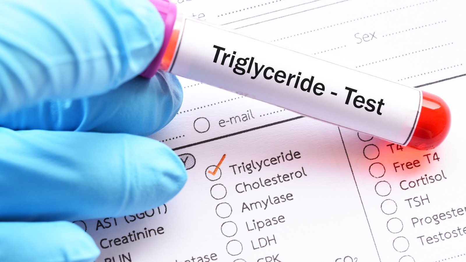 High triglycerides and cholesterol: Cardiologist explains why this combination is dangerous for heart