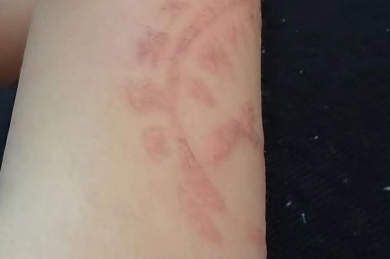 My little boy got a tattoo on holiday - now I fear he's scarred for life
