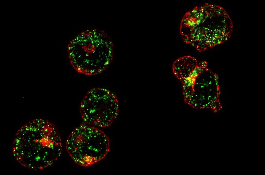 How red blood cells keep making hemoglobin under stress could reshape ...