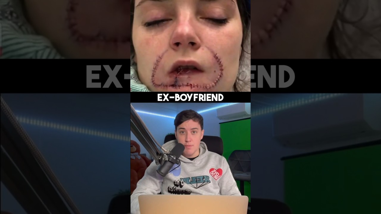 How a woman reconstructed her face after a violent attack