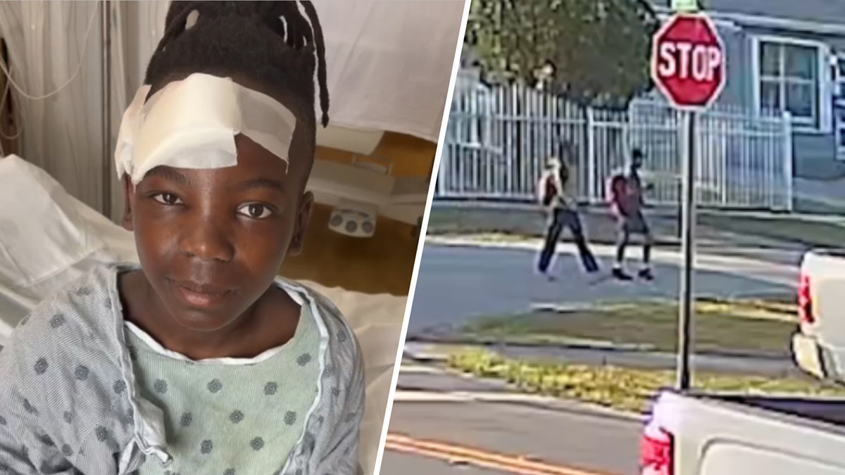 Inspiring Westfield Boy Hit By Car Pictures