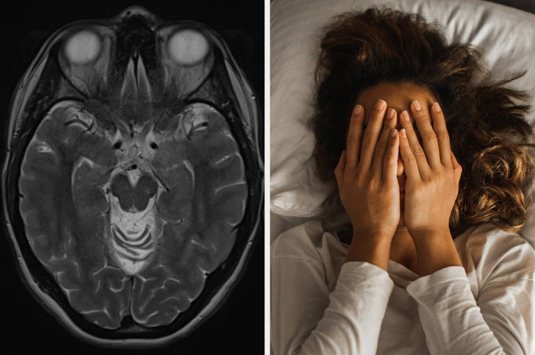 These 4 sleep problems could be dementia red flags
