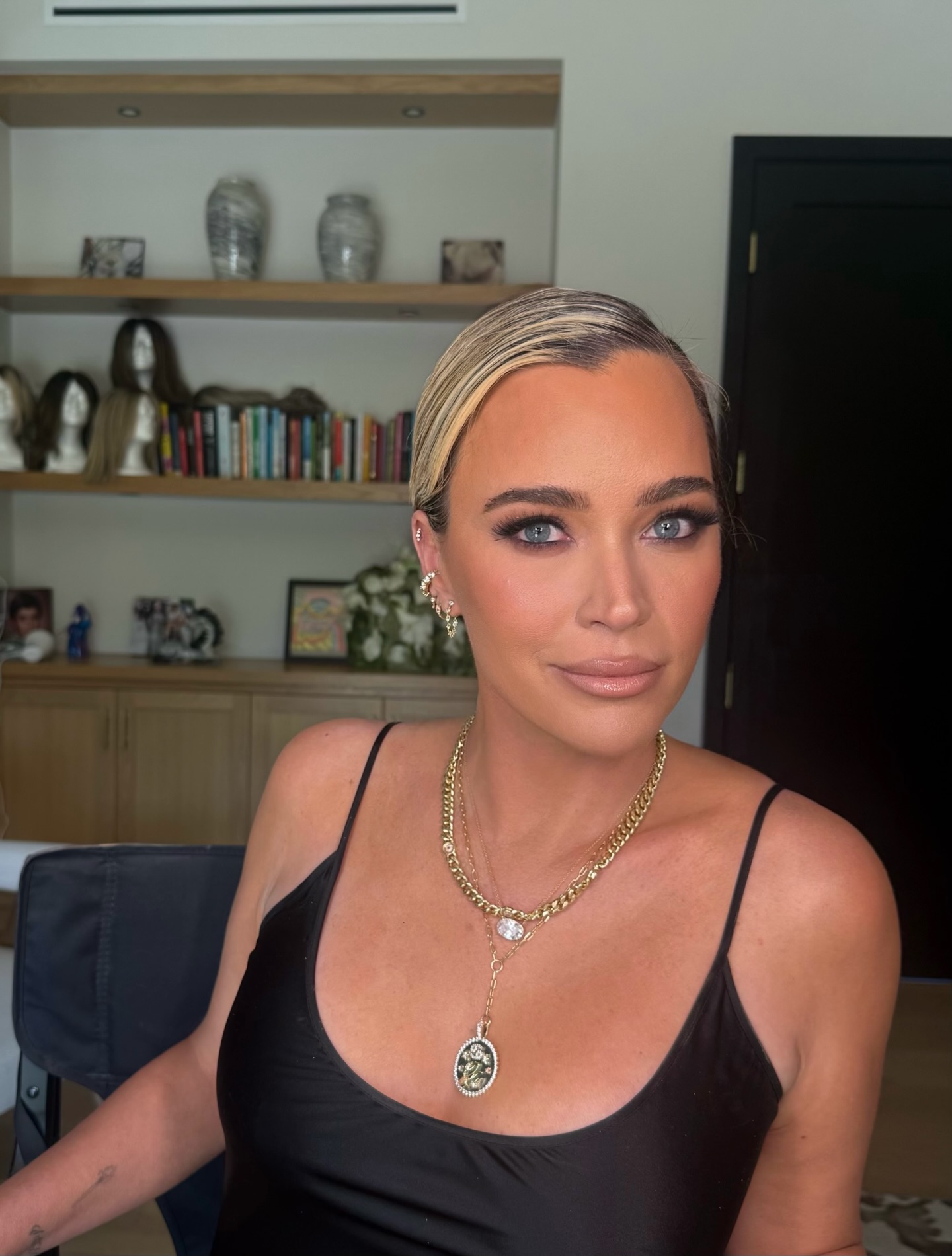 Teddi Mellencamp bravely showcases brain surgery scars as she battles ...