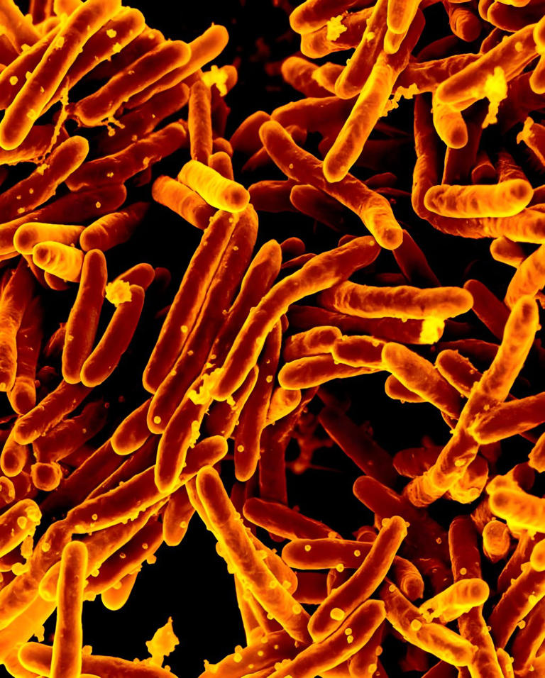 World’s deadliest disease rips across California as clusters discovered ...