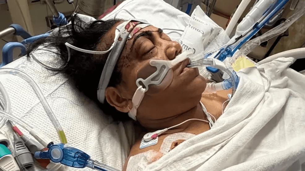 GoFundMe raises money for mother who lost her leg in Chambersburg crash