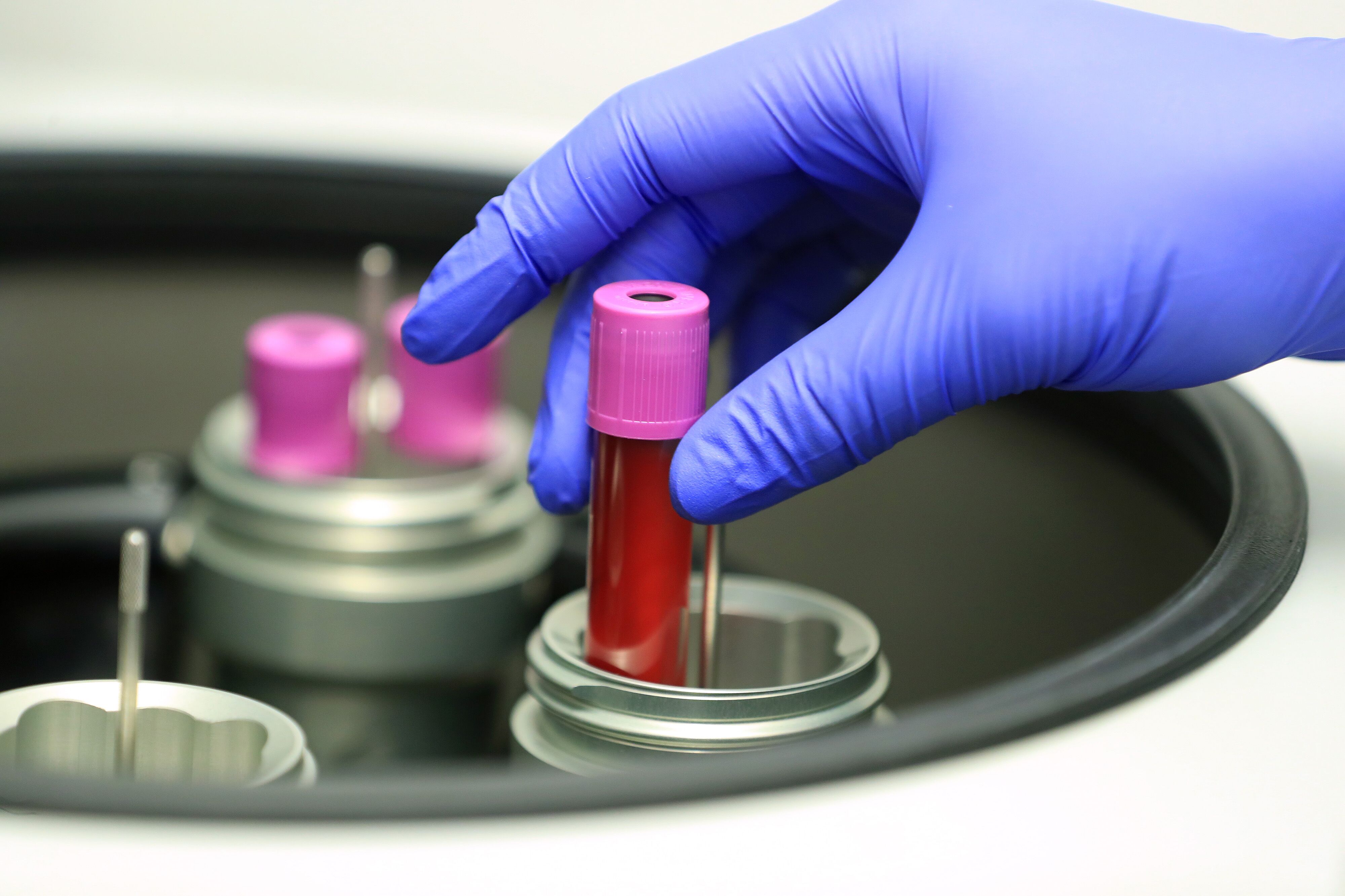 Novo-backed biotech Hemab raises $301.5 million in upsized IPO