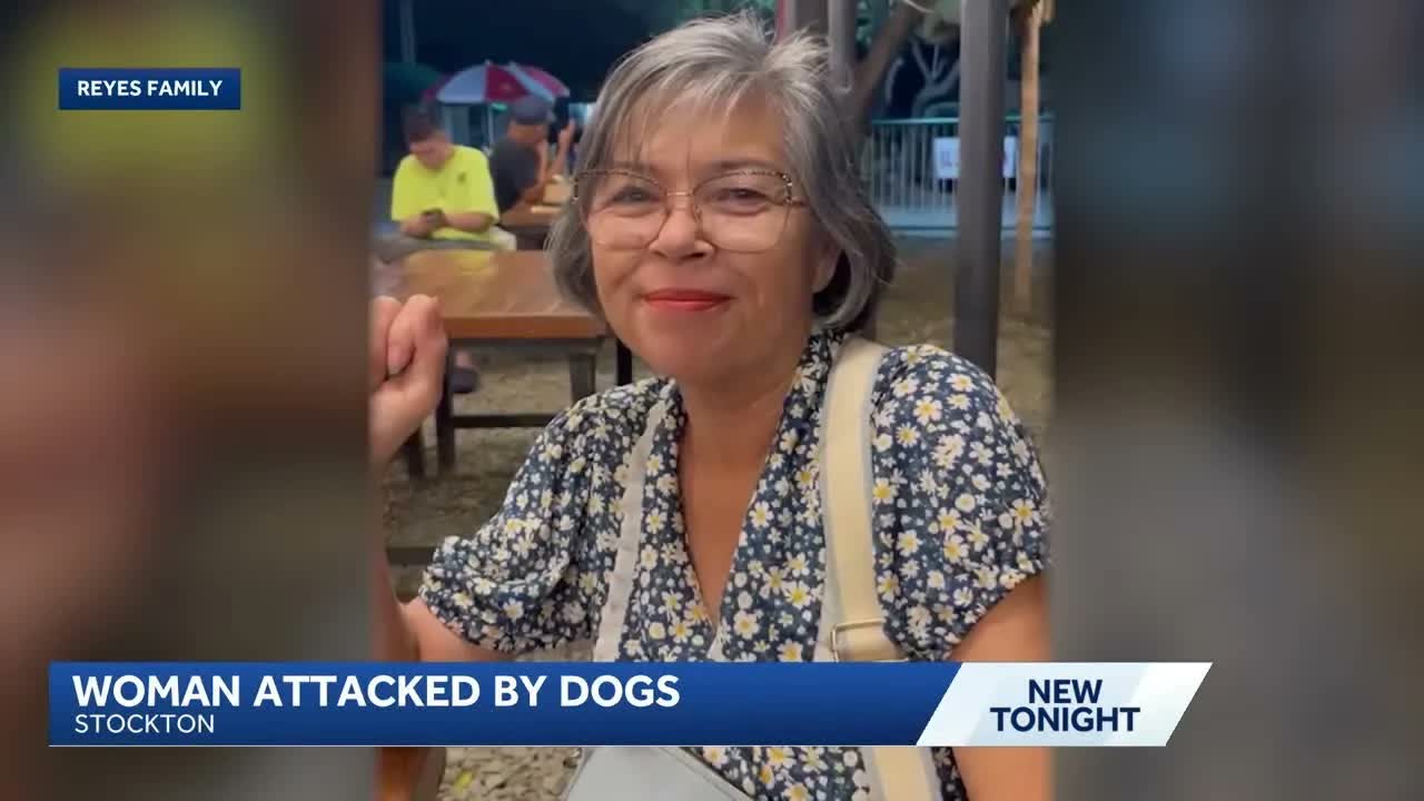 'Lacerations all over': Woman injured after being attacked by stray ...