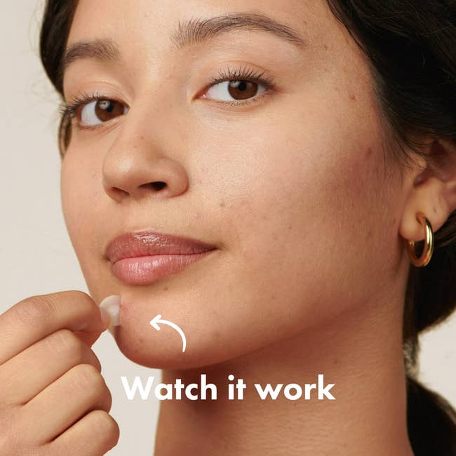 Person applying a skincare patch to their chin with text