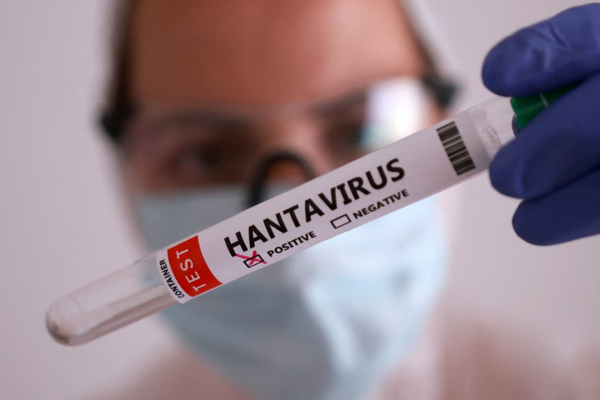 Could deadly hantavirus become the next global pandemic?