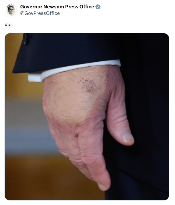 This new picture of Trump's hands during a press conference is going viral