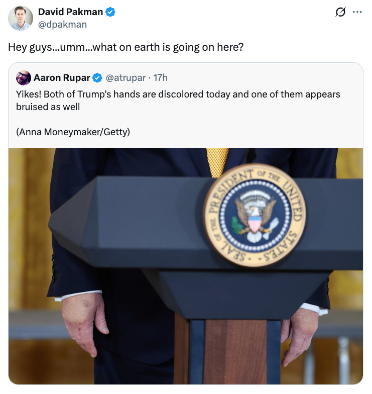 This new picture of Trump's hands during a press conference is going viral