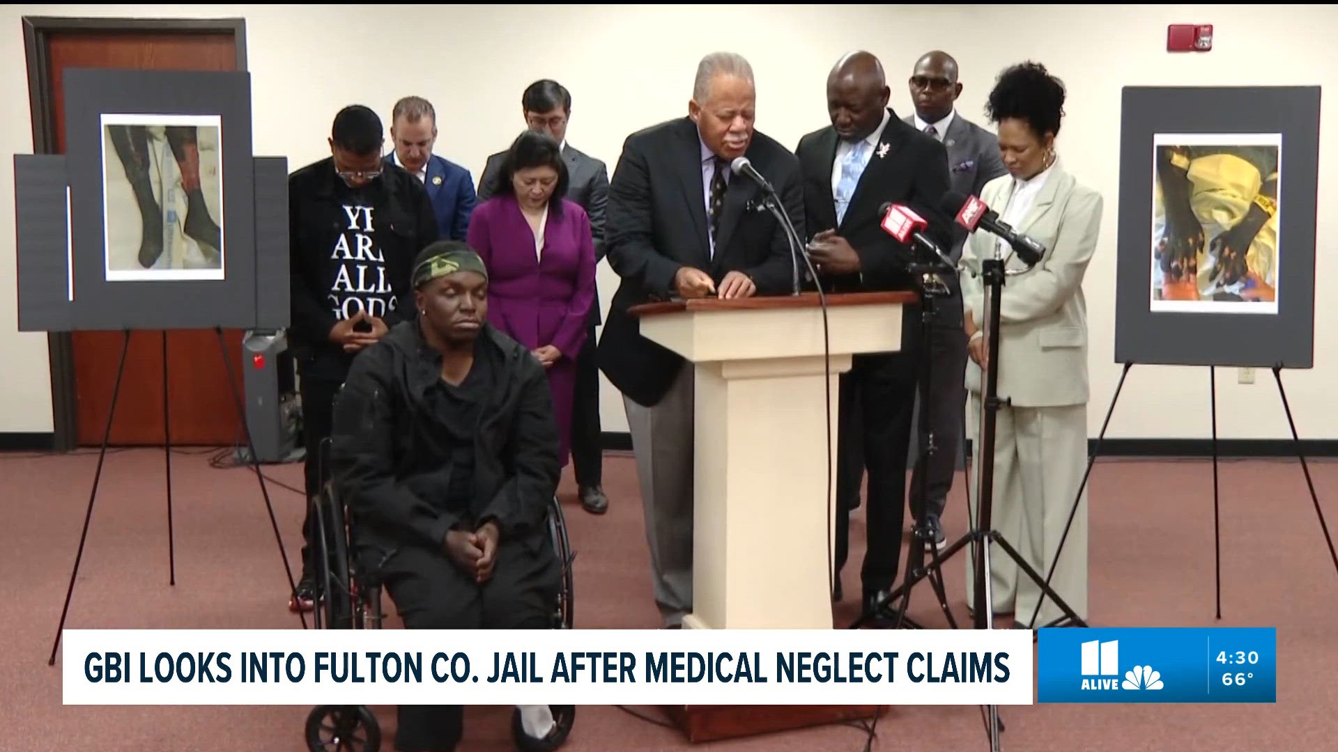 GBI reviewing case of man who lost limbs after septic shock at Fulton ...