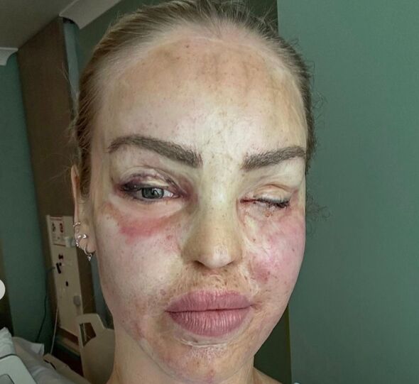 Over 2,600 acid attacks in Britain in less than 3 years - and huge ...