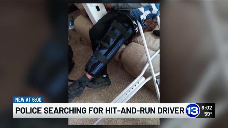 Toledo hit-and-run leaves bicyclist injured, TPD searching for driver