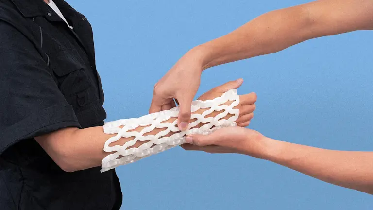 This 3D-printed cast shapes to your arm—and makes healing a broken bone ...