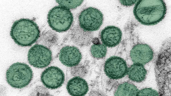 Could hantavirus become the next pandemic? Georgia officials monitor ...