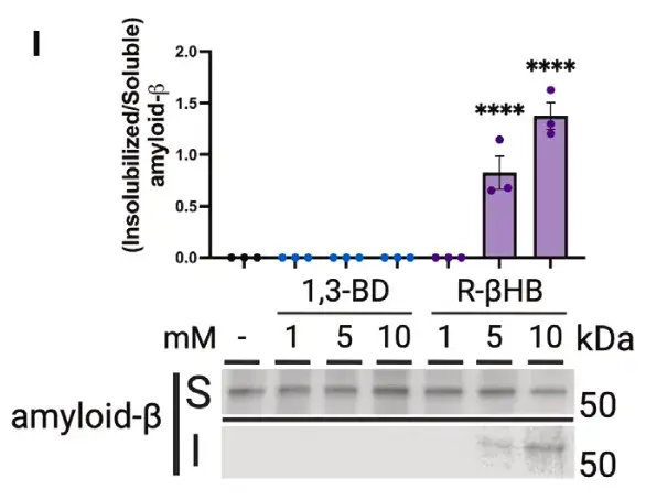 New mechanism on how ketones clean a messy brain in Alzheimer's disease