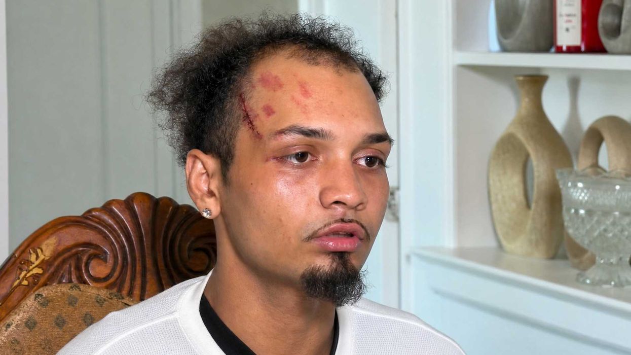New York man speaks out after ICE mistakenly beats him