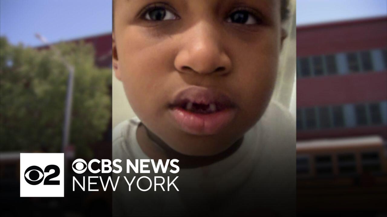 Mom demands answers after son returns from school with missing teeth
