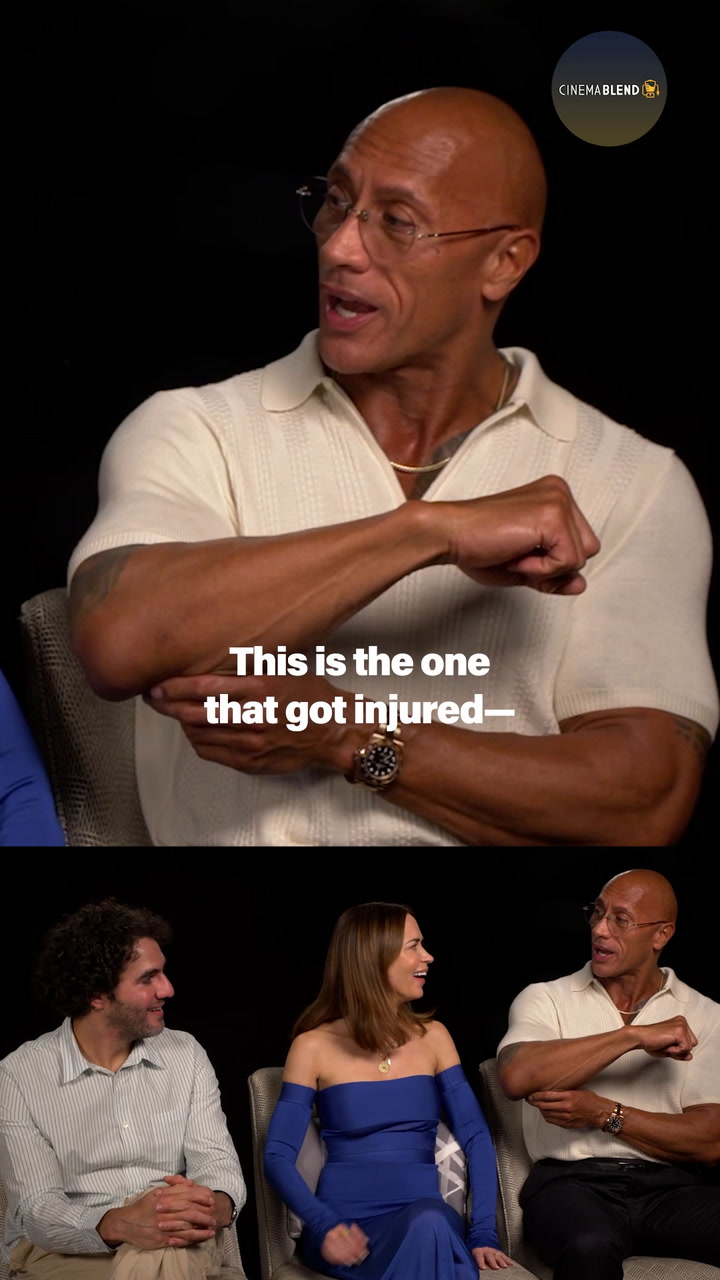 Dwayne Johnson shows off a real injury from 'The Smashing Machine'