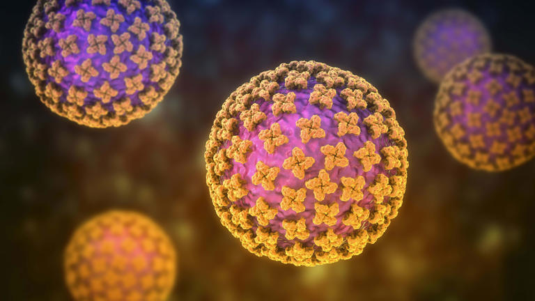 Hantavirus explained: Early symptoms are mild, but organ failure ...