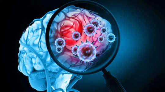 'I ignored my morning headache': Doctors warn this common 6 AM symptom ...