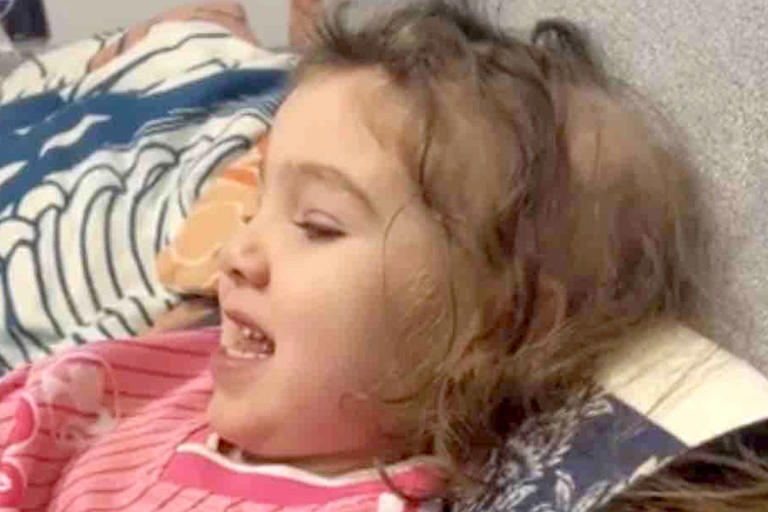 Girl, 4, loses 80% of her hair to alopecia. Embarrassed to start ...