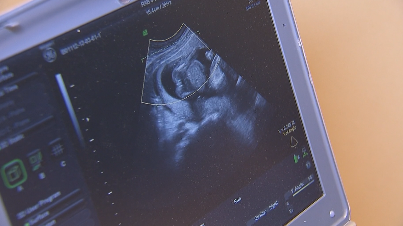 UnityPoint Health - Meriter using screening initiative to combat ...