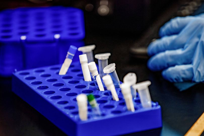 Hantavirus bombshell as 2 vials of deadly rat virus vanished from ...