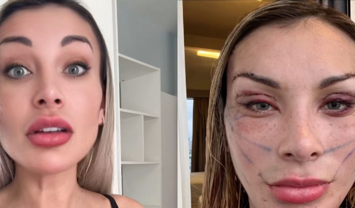 Antes e depois de Andressa Urach: 'toda esticada' em novo vídeo ...