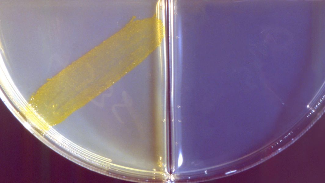 Fermentation secrets your gut will thank you for