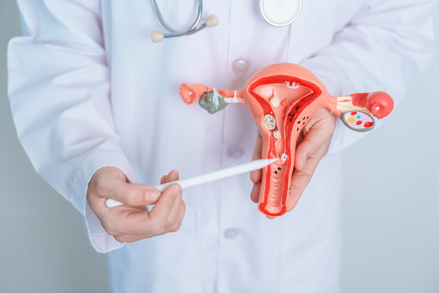 Conisation et HPV : le Dr Olivier Marpeau explique cette opération qui ...